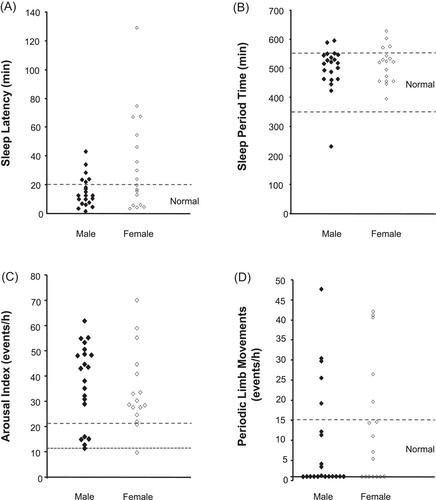 High prevalence of severe sleep cycle disruption in de novo acromegaly and underdiagnosis by common clinical screening tools: A prospective, observational, cross-sectional study