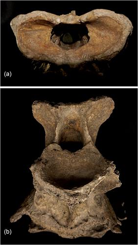 Conjoined first (atlas) and second (axis) cervical vertebrae in an eastern wapiti (Cervus canadensis canadensis) from the Angel Site (1000–1400 CE, Indiana, USA)