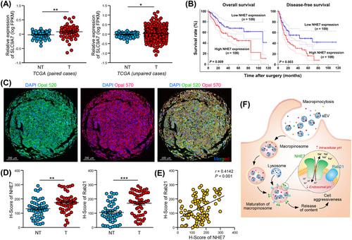 NHE7 upregulation potentiates the uptake of small extracellular vesicles by enhancing maturation of macropinosomes in hepatocellular carcinoma