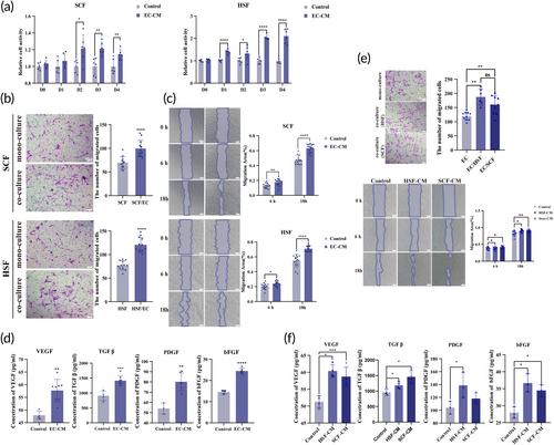 Fibroblasts and endothelial cells interplay drives hypertrophic scar formation: Insights from in vitro and in vivo models