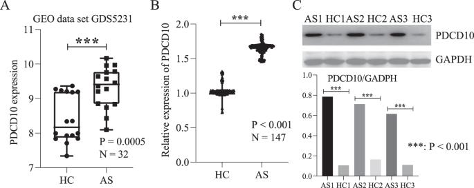 Programmed cell death 10 can be used as a potential biomarker for ankylosing spondylitis diagnosis and treatment