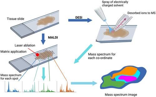 Metabolomics at the tumor microenvironment interface: Decoding cellular conversations