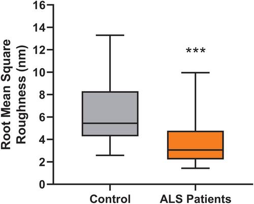 Erythrocytes' surface properties and stiffness predict survival and functional decline in ALS patients