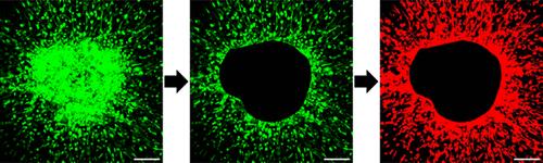 Automated Analysis of Extracellular Matrix Invasion of Cancer Cells from Tumor Spheroids