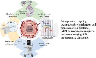 Intraoperative glioblastoma surgery-current challenges and clinical trials: An update