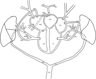 Morphological variations on vital systems in a conjoined twin