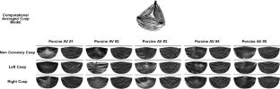 Fluid–structure interaction modeling of compliant aortic valves using the lattice Boltzmann CFD and FEM methods