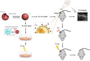 Ultrasound-guided chemoradiotherapy of breast cancer using smart methotrexate-loaded perfluorohexane nanodroplets