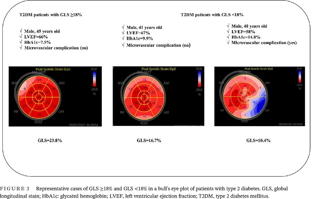 Assessment of subclinical left ventricular systolic dysfunction in patients with type 2 diabetes: Relationship with HbA1c and microvascular complications
      2型糖尿病患者亚临床左心室收缩功能障碍的评估:与糖化血红蛋白和微血管并发症的关系