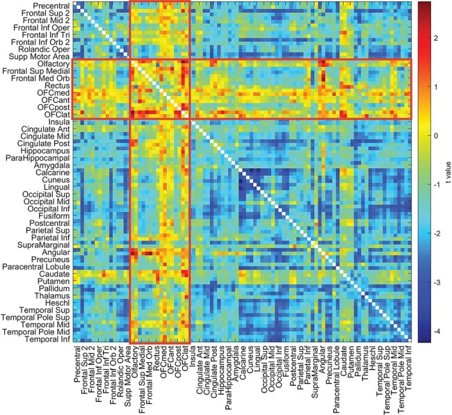 Orbitofrontal cortex connectivity is associated with food reward and body weight in humans.