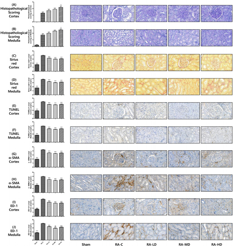 Efficacy and Safety of Human Bone Marrow-Derived Mesenchymal Stem Cells according to Injection Route and Dose in a Chronic Kidney Disease Rat Model.