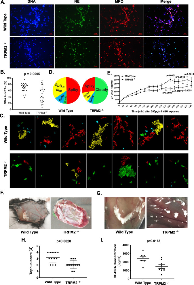 Transient receptor potential melastatin 2 regulates neutrophil extracellular traps formation and delays resolution of neutrophil-driven sterile inflammation.