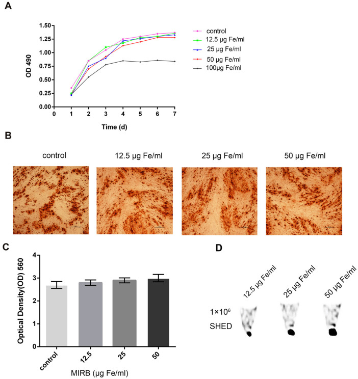 Tracking of Stem Cells from Human Exfoliated Deciduous Teeth Labeled with Molday ION Rhodamine-B during Periodontal Bone Regeneration in Rats.