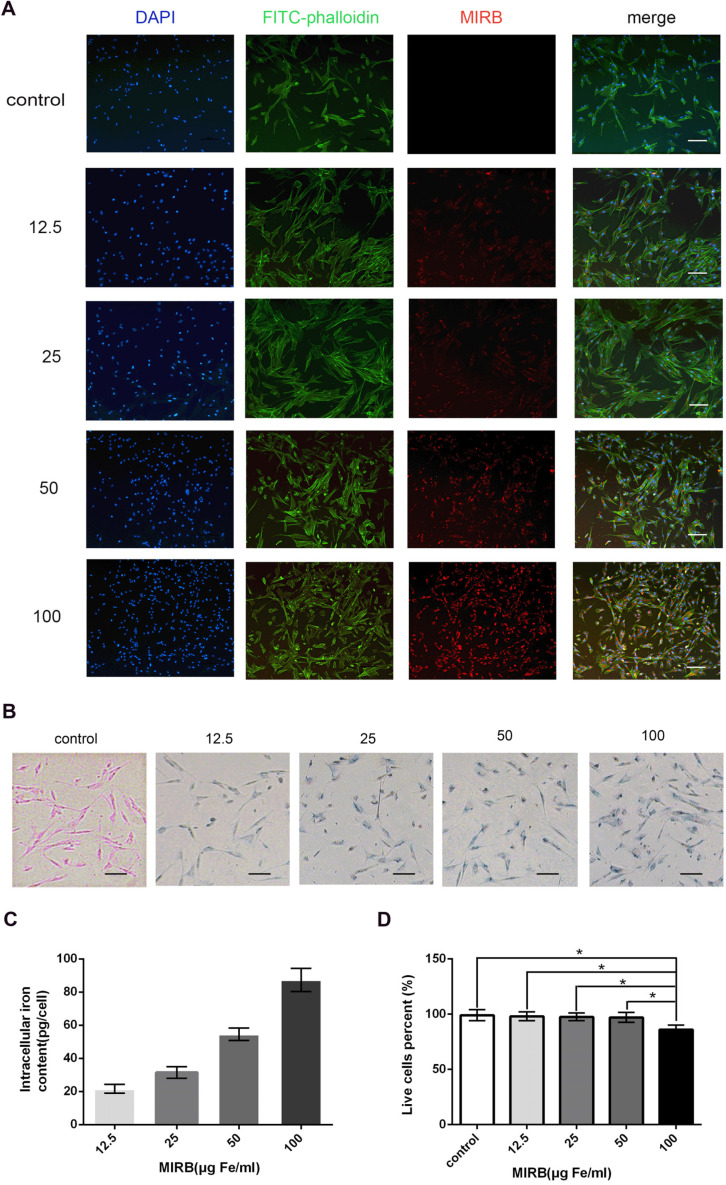 Tracking of Stem Cells from Human Exfoliated Deciduous Teeth Labeled with Molday ION Rhodamine-B during Periodontal Bone Regeneration in Rats.