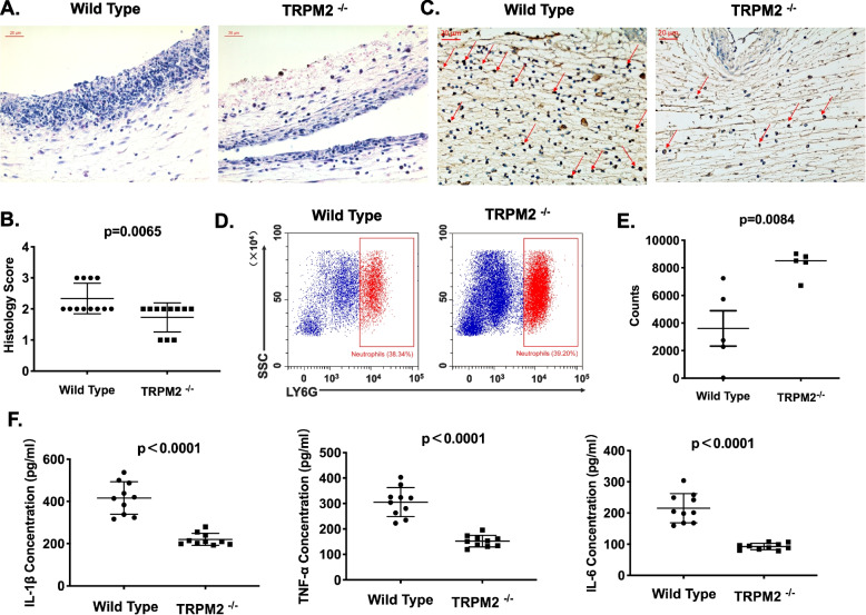 Transient receptor potential melastatin 2 regulates neutrophil extracellular traps formation and delays resolution of neutrophil-driven sterile inflammation.