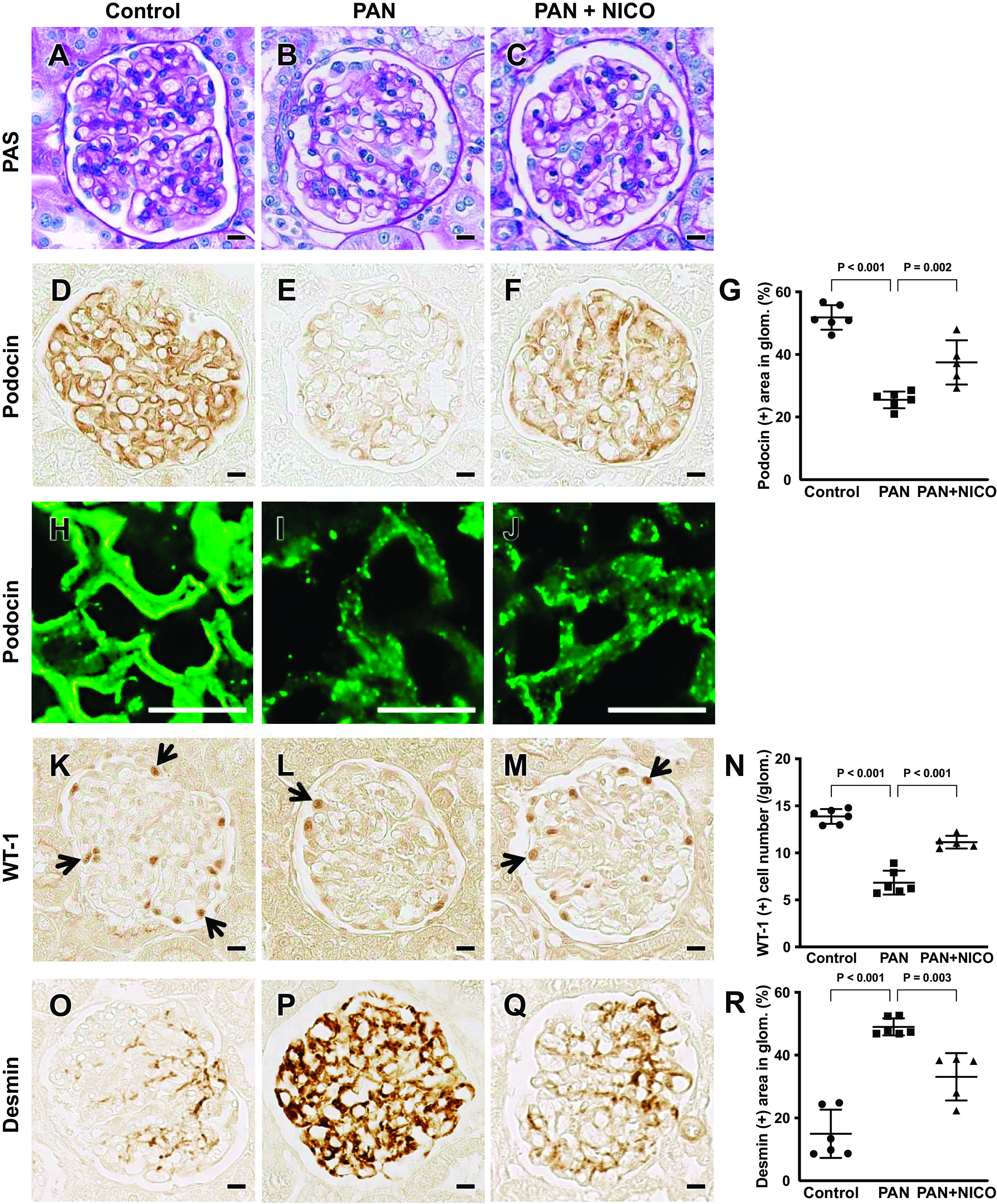 Nicorandil protects podocytes via modulation of antioxidative capacity in acute puromycin aminonucleoside-induced nephrosis in rats.