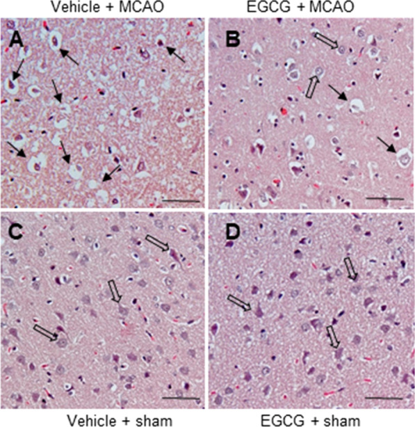 Epigallocatechin gallate restores the reduction of protein phosphatase 2 A subunit B caused by middle cerebral artery occlusion.