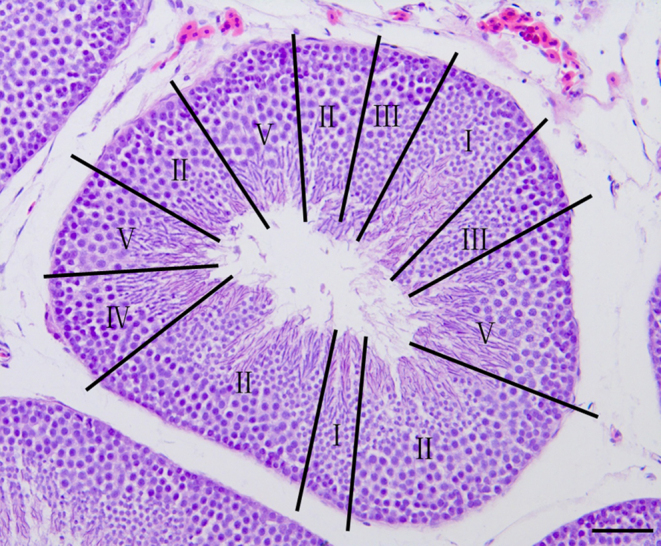 Study on the pattern of spermatogenesis during the breeding season of the Chinese soft-shelled turtle, Pelodiscus sinensis (Reptilia: Trionychidae).