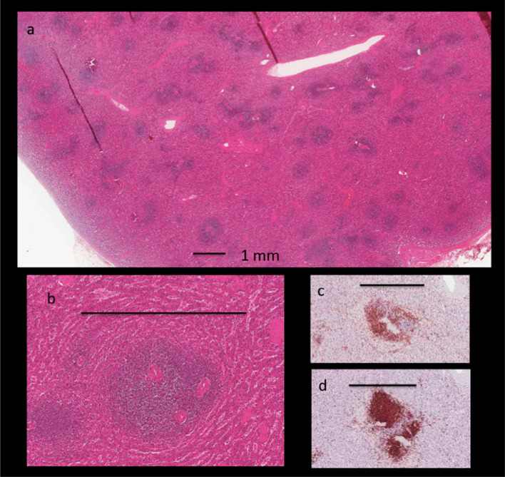 "Sponge pattern" of the spleen: a rarely described high-frequency ultrasound pattern in HIV-positive patients.