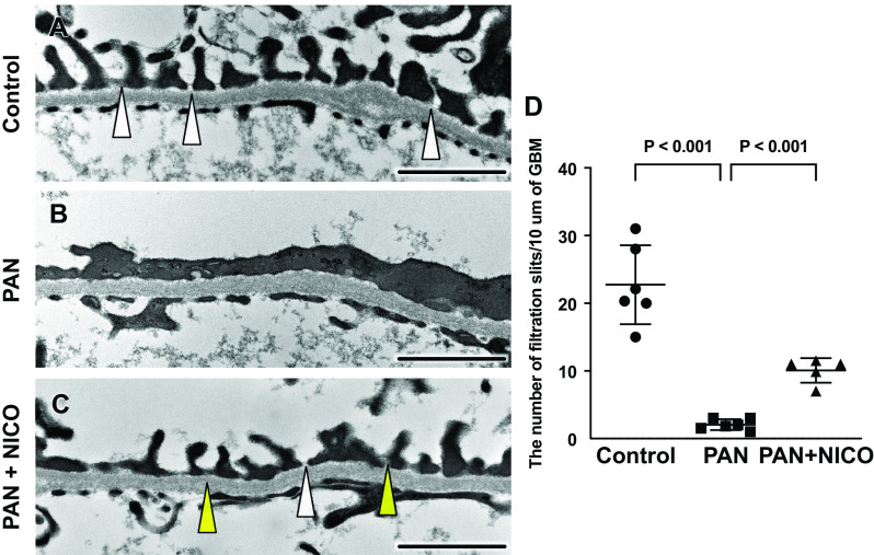 Nicorandil protects podocytes via modulation of antioxidative capacity in acute puromycin aminonucleoside-induced nephrosis in rats.