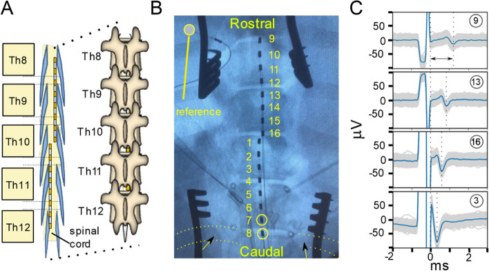 Characterization and applications of evoked responses during epidural electrical stimulation.