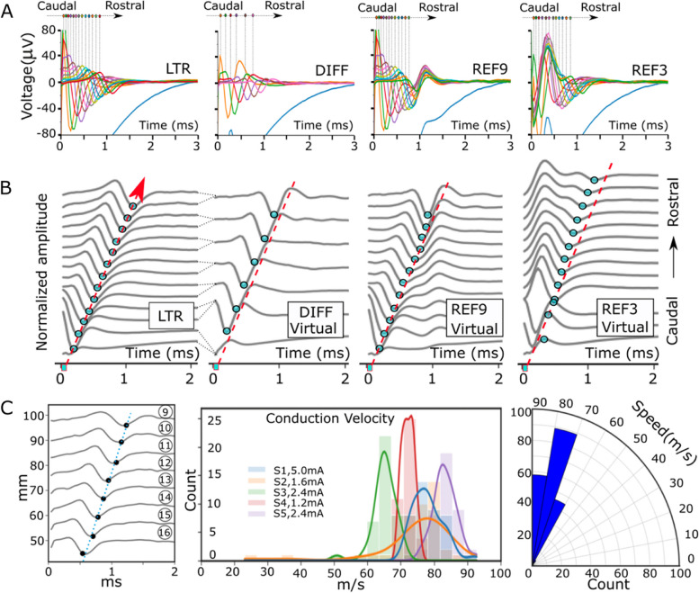 Characterization and applications of evoked responses during epidural electrical stimulation.