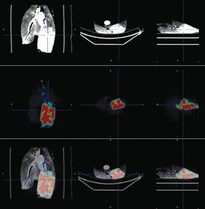 Positron Emission Tomography-Computed Tomography Imaging of Selective Lobar Delivery of Stem Cells in <i>Ex Vivo</i> Lung Model of Mechanical Ventilation.