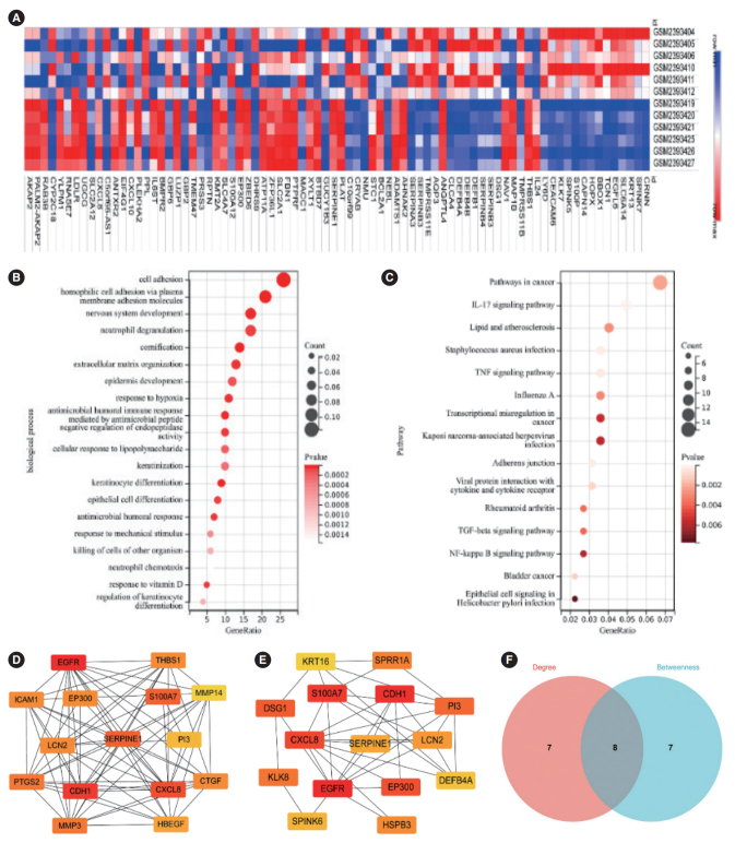 SERPINE1 as an Independent Prognostic Marker and Therapeutic Target for Nicotine-Related Oral Carcinoma.