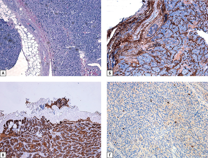 [Casuistic cases of parathyroid carcinoma with a verified mutation in the <i>MEN1</i> gene].