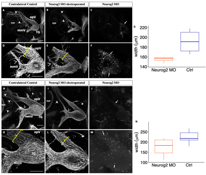 Neurogenin 2 and Neuronal Differentiation 1 Control Proper Development of the Chick Trigeminal Ganglion and Its Nerve Branches.