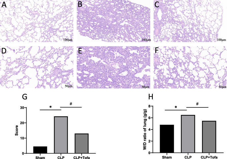 Tofacitinib reduces acute lung injury and improves survival in a rat model of sepsis by inhibiting the JAK-STAT/NF-κB pathway.