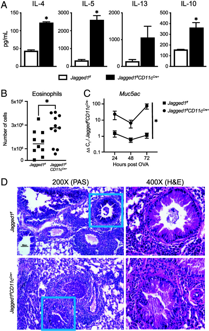 Jagged-1 Reduces Th2 Inflammation and Memory Cell Expansion in Allergic Airway Disease.