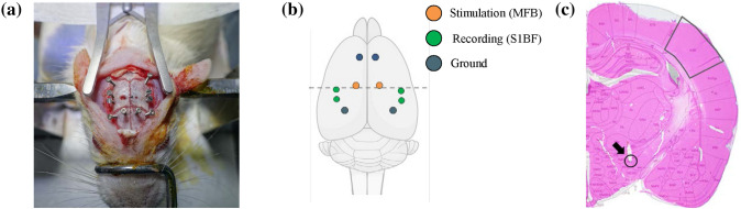 Somatosensory ECoG-based brain-machine interface with electrical stimulation on medial forebrain bundle.