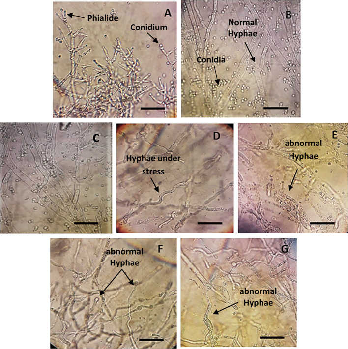 Alleviation of the adverse effects of NaCl stress on tomato seedlings (Solanum lycopersicum L.) by Trichoderma viride through the antioxidative defense system.