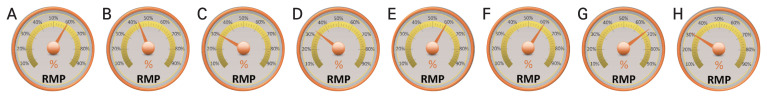 Peripheral Defocus and Myopia Management: A Mini-Review.