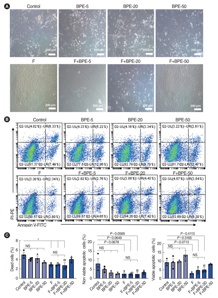 Development of a Serum-Free Culture Method for Endothelial Cells of the Stria Vascularis and Their Pro-Inflammatory Secretome Changes Induced by Oxidative Stress.