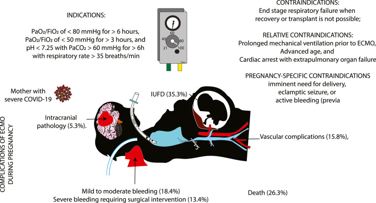 Extracorporeal membrane oxygenation in pregnancy during the SARS-CoV-2 pandemic