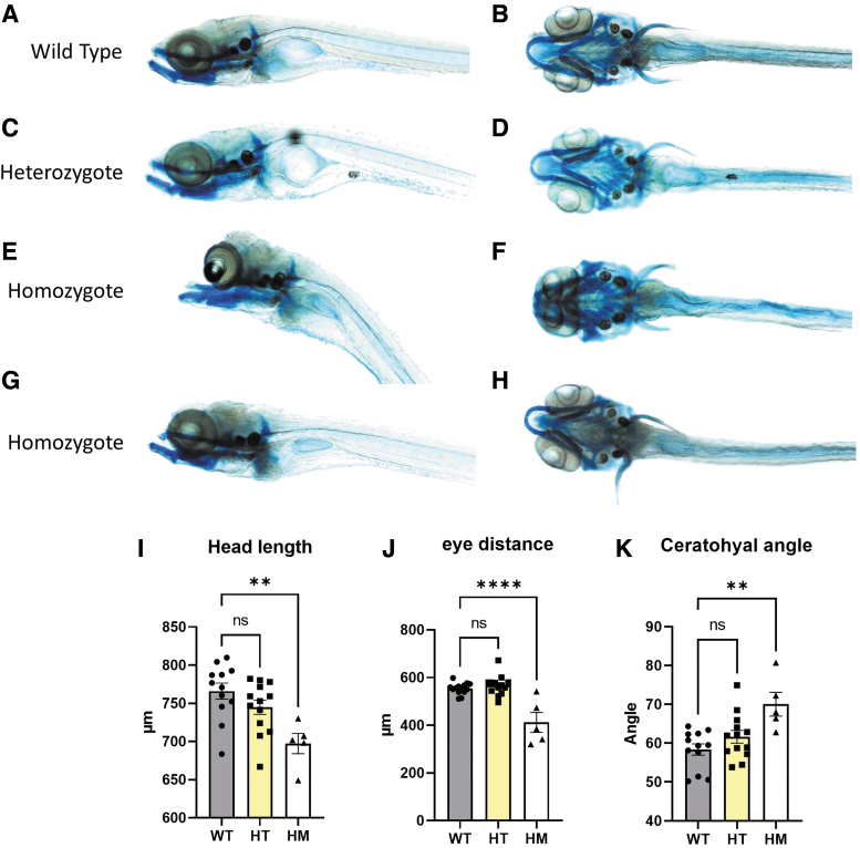 <i>wnt11f2</i> Zebrafish, an Animal Model for Development and New Insights in Bone Formation.