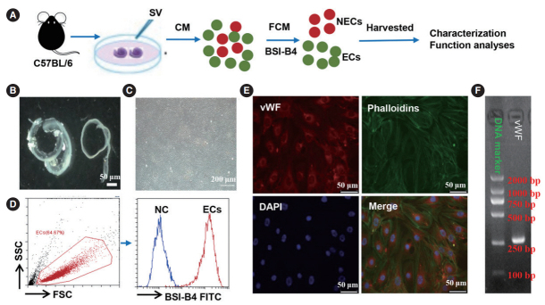 Development of a Serum-Free Culture Method for Endothelial Cells of the Stria Vascularis and Their Pro-Inflammatory Secretome Changes Induced by Oxidative Stress.