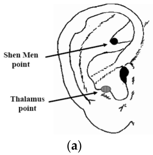 Effect of Low- and High-Frequency Auricular Stimulation with Electro-Acupuncture on Cutaneous Microcirculation: A Cross-Over Study in Healthy Subjects.