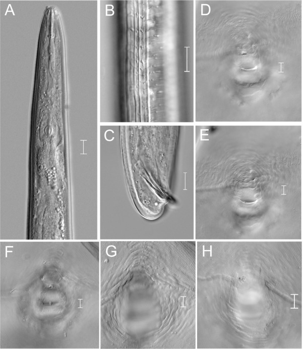 <i>Meloidogyne paramali</i> n. sp. (Nematoda: Meloidogyninae) and First Report of <i>M. marylandi</i> in maple and yacca tree from Japan.