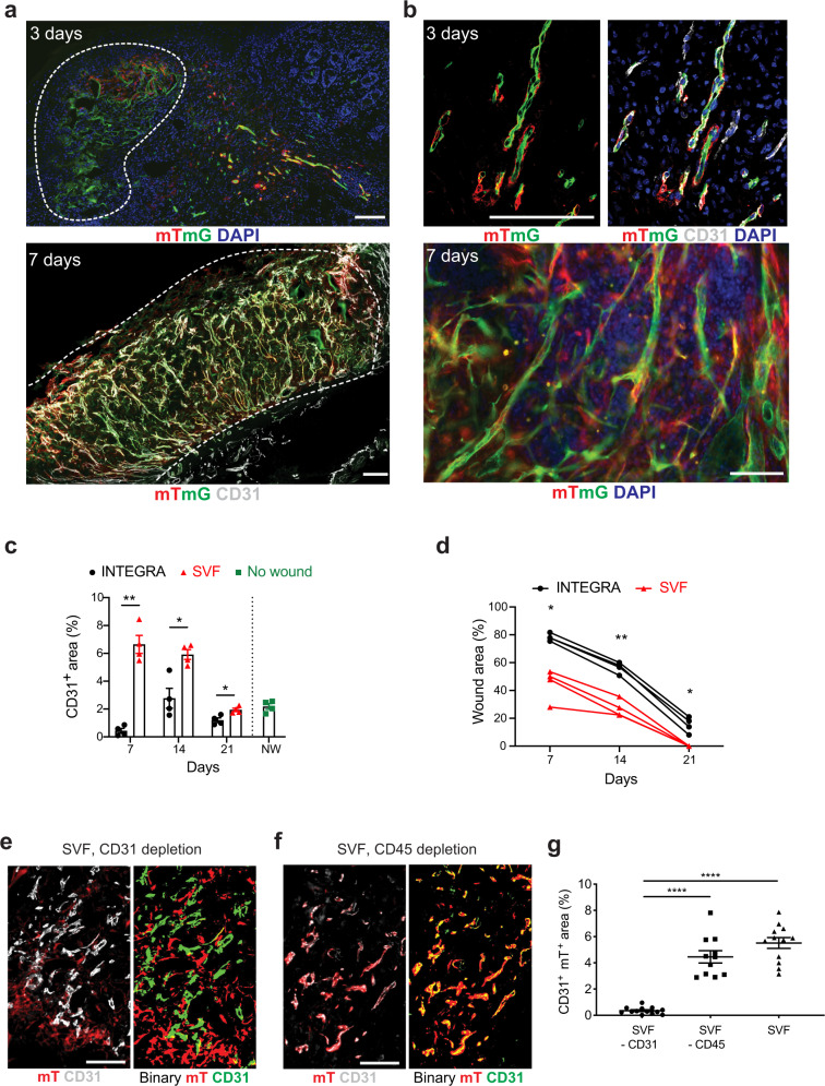 Ischemic wound revascularization by the stromal vascular fraction relies on host-donor hybrid vessels.