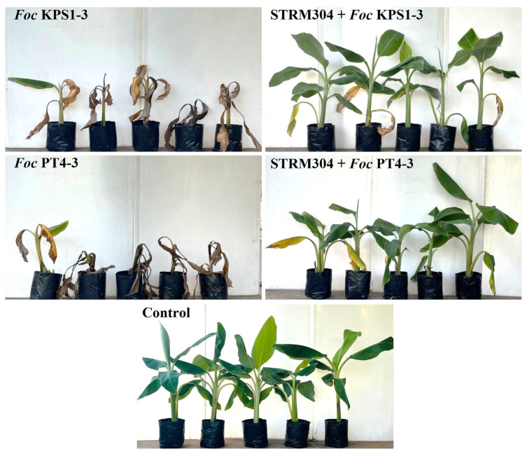 Evaluation of Soil Streptomyces spp. for the Biological Control of Fusarium Wilt Disease and Growth Promotion in Tomato and Banana.