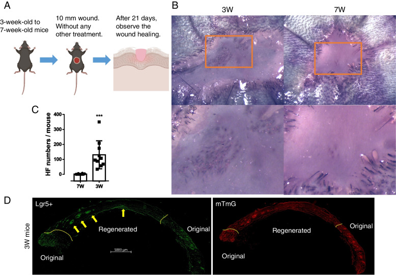 Injury-induced interleukin-1 alpha promotes Lgr5 hair follicle stem cells de novo regeneration and proliferation via regulating regenerative microenvironment in mice.