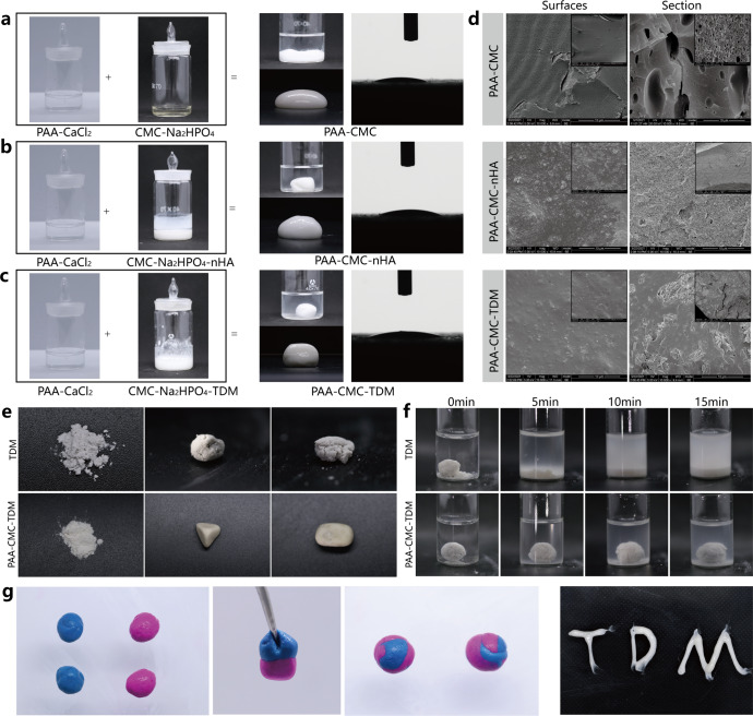 Biomineralization-inspired mineralized hydrogel promotes the repair and regeneration of dentin/bone hard tissue.