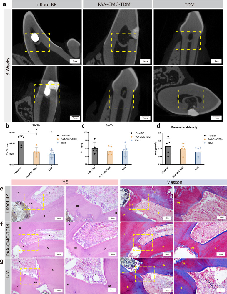 Biomineralization-inspired mineralized hydrogel promotes the repair and regeneration of dentin/bone hard tissue.