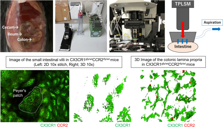 Intravital imaging of immune responses in intestinal inflammation.