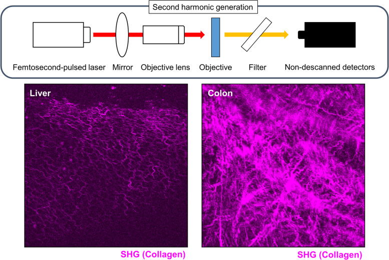 Intravital imaging of immune responses in intestinal inflammation.