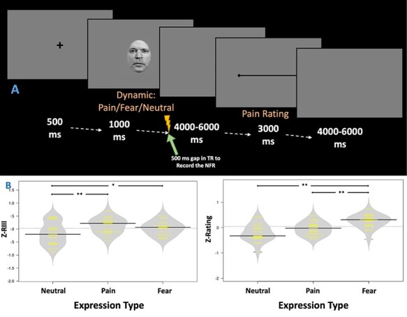 Brain responses to the vicarious facilitation of pain by facial expressions of pain and fear.