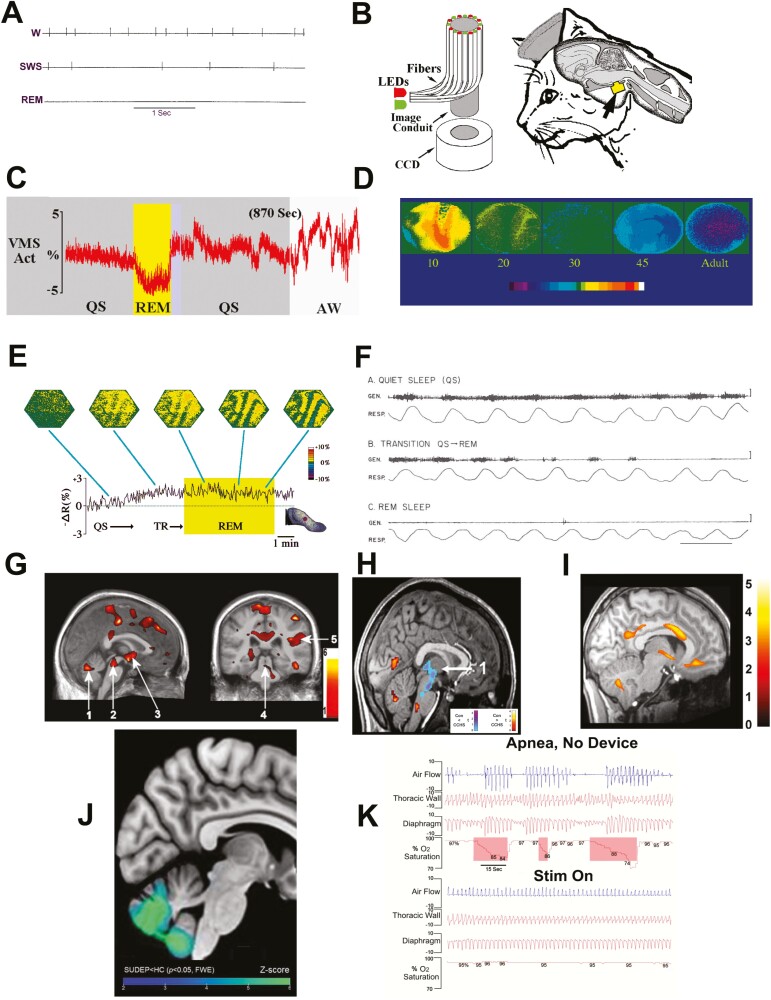 Exploring the brain with sleep-related injuries, and fixing it.